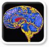 Neurologie