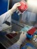 Transplant cu celule hematopoietice