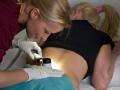 Dermatoscopie