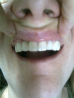 Reconstrucție dentară LORIMED după