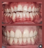 Cazuri DENTA CARE