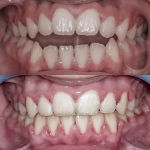 Cazuri Denta Care