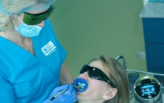 Tratamente albire dentara Dent Complet