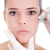 Chirurgie estetica